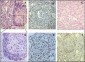 GREMLIN Antibody (C-term)